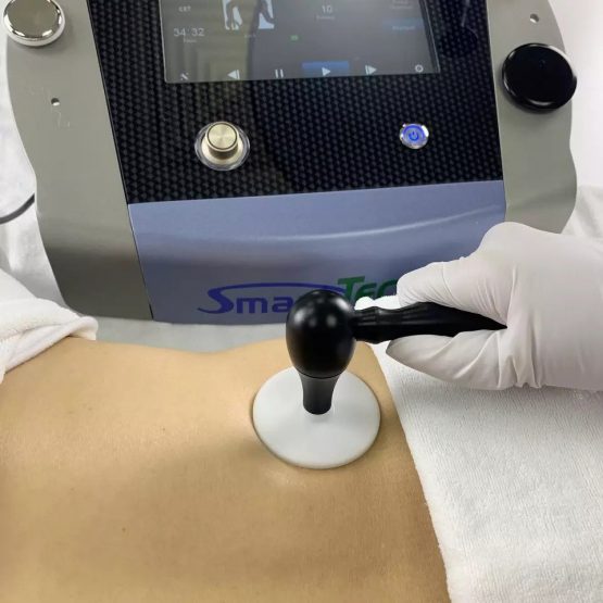 Diatermia Smart tecar 3 - Imagen 2