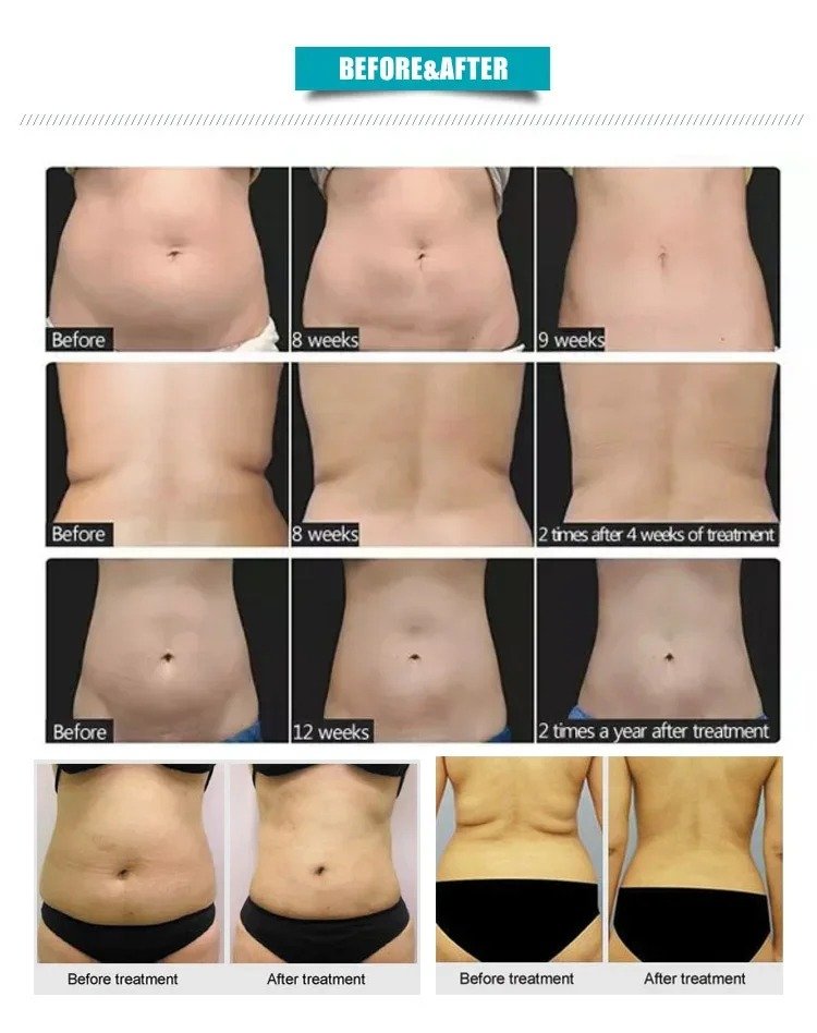 Body Sculptor - Imagen 4