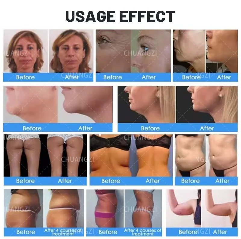 Body Sculptor - Imagen 5